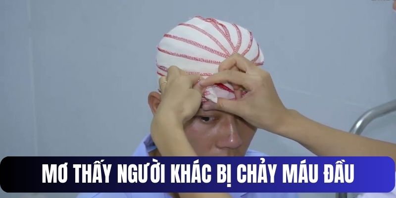 Giấc mộng thấy người khác chảy máu đầu và ý nghĩa đặc biệt